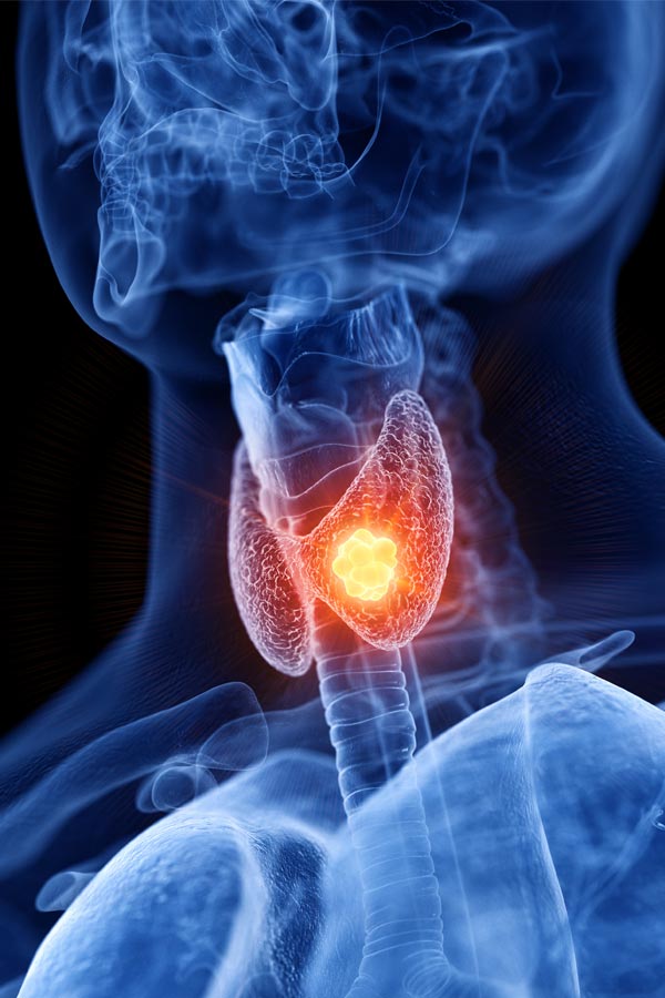 Thyroid-Treatment-Ledda-Soldotna-Anchorage-Alaska Thyroid Treatment Ledda Soldotna Anchorage Alaska